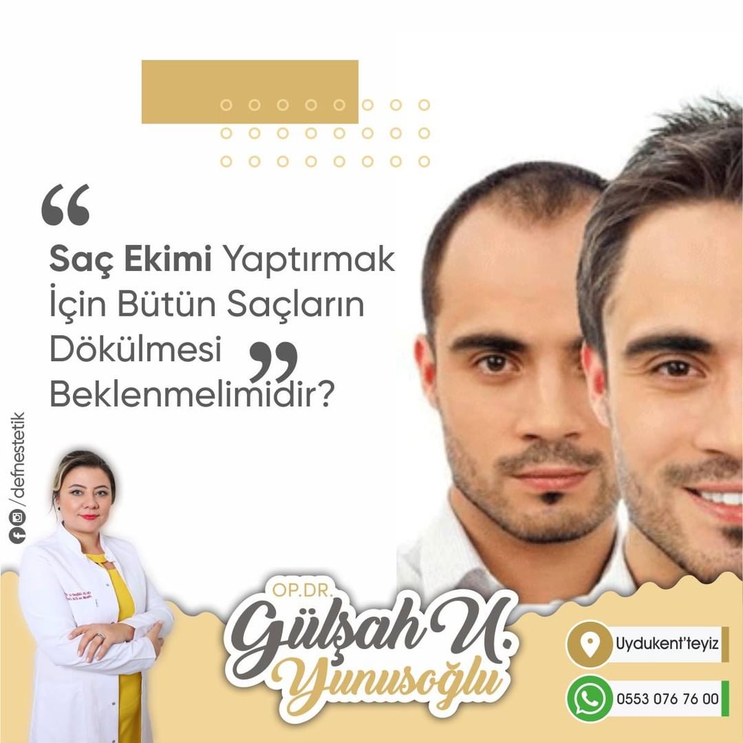 Enseden en fazla kaç greft alınabilir?